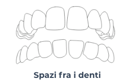 Diastema - Ortodonzia Conegliano